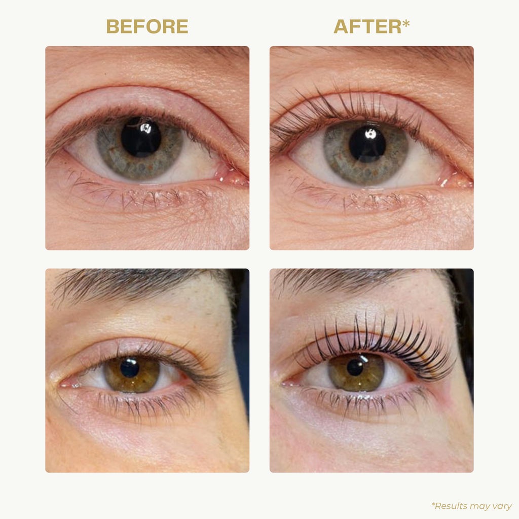 CurlEase™ - Ultimate Heated Electric Eyelash Curler