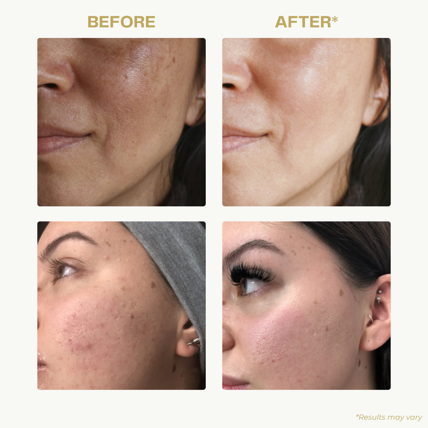 SilkGlow™ Facial Cleansing Brush