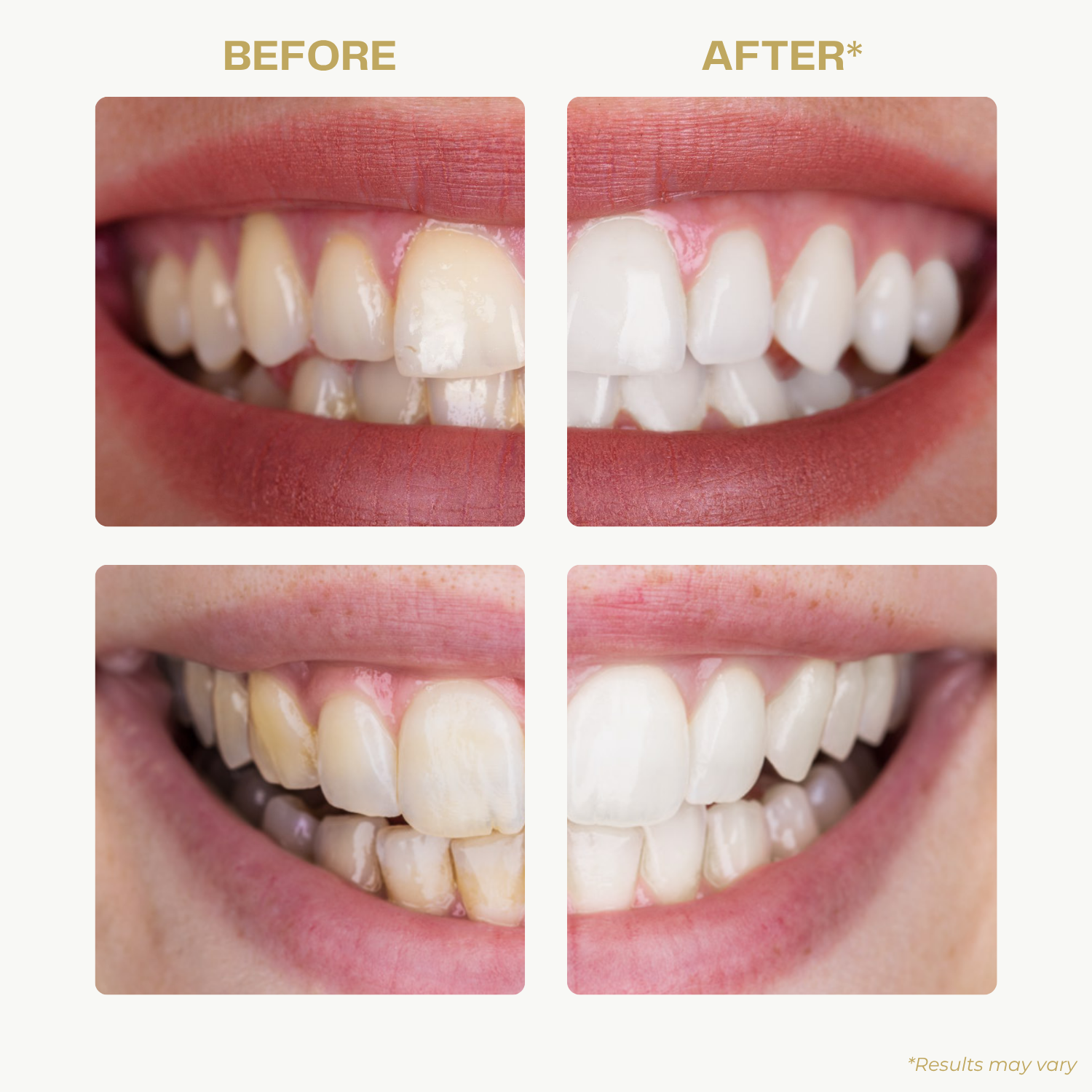 ZenBrush™ - Premium Electric Toothbrush